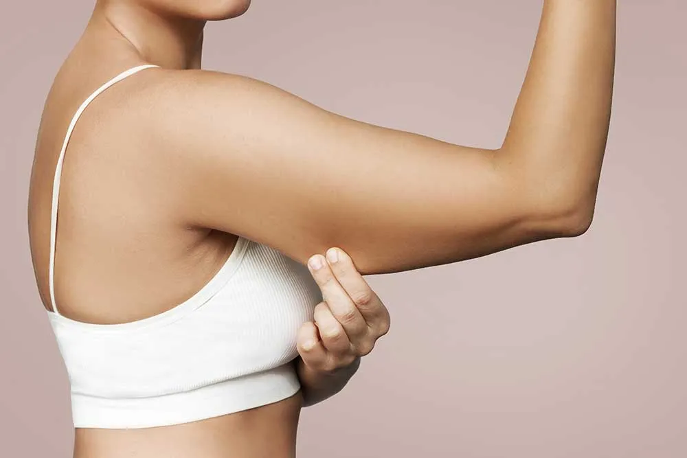 Arm Lift Scars: Understanding, Managing, and Minimizing Post-Surgery Scarring