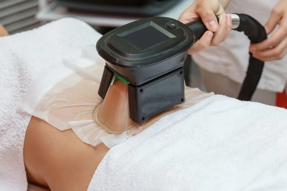 Cryolipolysis Cost: Comprehensive Guide to Fat-Freezing Pricing