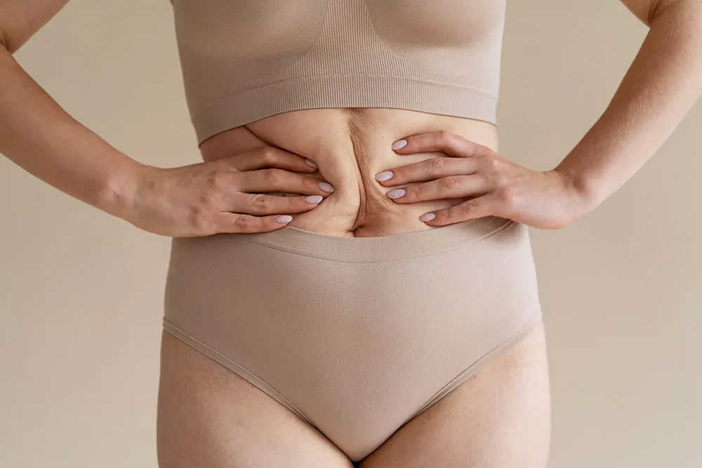 How to Lose Abdominal Fat in a Week: Effective Short-Term Strategies