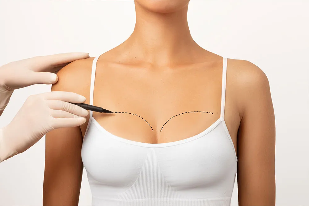 Natural Breast Augmentation: A Comprehensive Guide