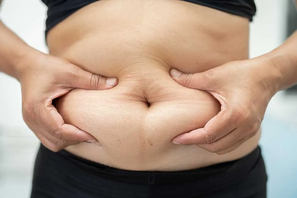 Tummy Tuck Surgery Recovery: Essential Guidelines and Tips for Optimal Healing